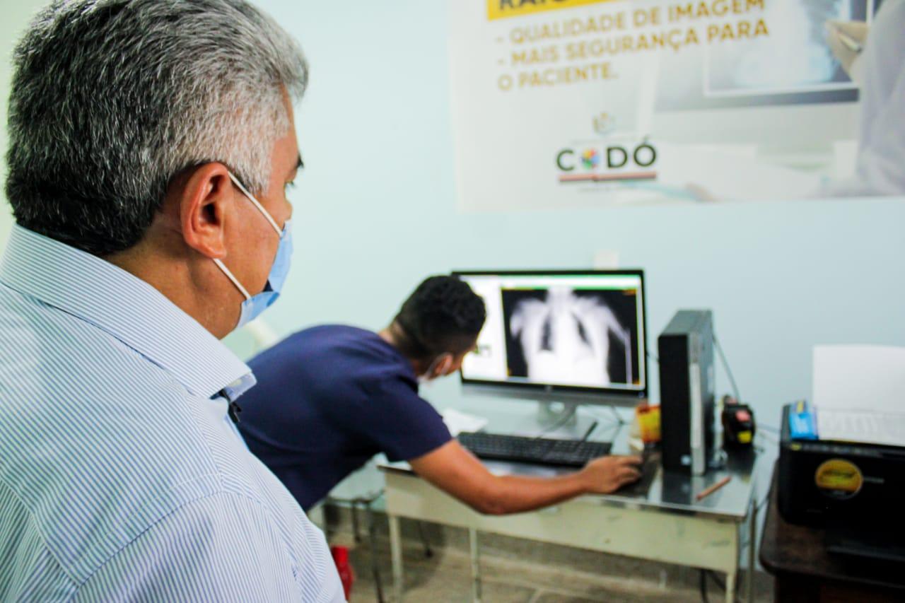 Pacientes são beneficiados com o retorno do Raio-X digital no HGM de Codó
